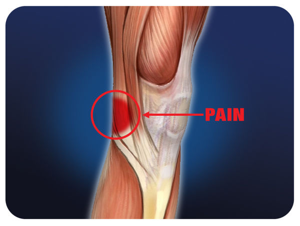 Pain Behind Knee Med Health